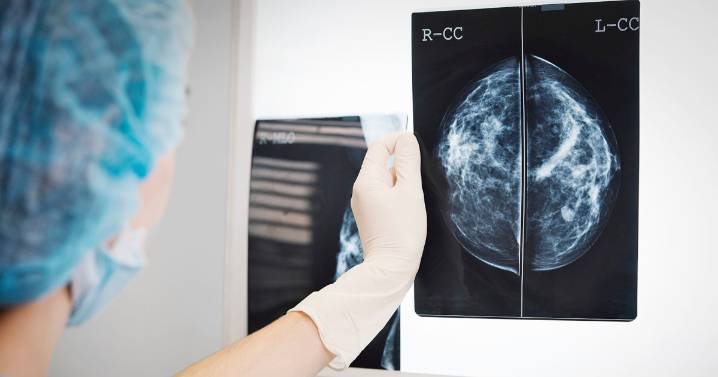 New study reveals how fat cells can fuel cancer tumors