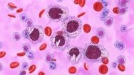 Age Is Just a Number: Blood Cancer Care in Older Patients