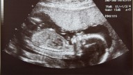 Homeschooled Kid Graduates High School 5 Months Before Birth