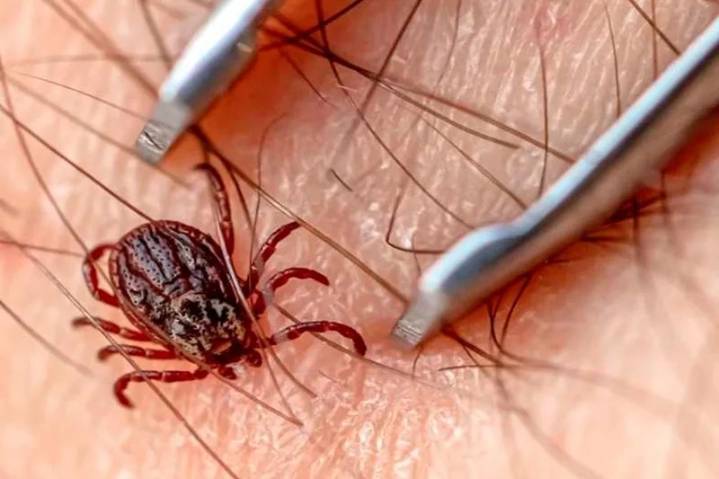 Aumentan las picaduras de garrapatas en EE.UU.: más casos de Lyme y riesgos por el cambio climático