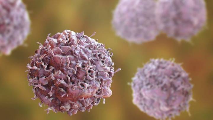 Promising vaccine may prevent certain cancers from returning