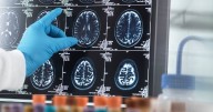 Daily morning hot drink could slash risk of brain decline