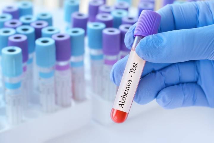 La FDA exige más controles a Biogen por riesgos en su fármaco para el Alzheimer Leqembi