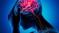 La triple carga de la migraña: dolor, depresión y trastornos del sueño