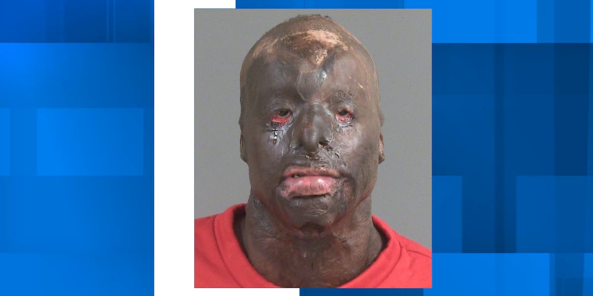 North Charleston Police bring Santee attempted murder suspect into custody