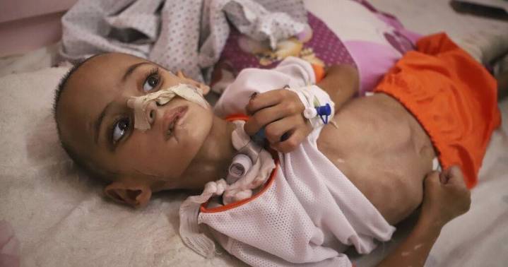 Israeli strikes and gunfire kill 33 as Gaza City becomes focus of famine and a military offensive