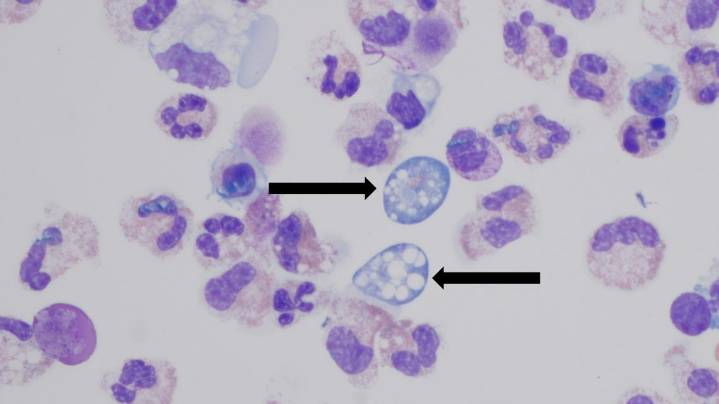 Brain-eating amoeba confirmed in Missouri: What to know about the dangerous organism