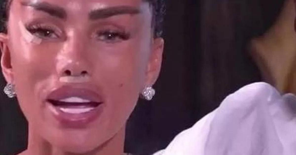 Katie Price pulls stitches out of own face in sickening facelift blunder