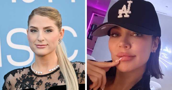 15 Before-And-After Photos Of Celebs Who Replaced Regular Botox With “Lip Flip” For A New Kind Of Look