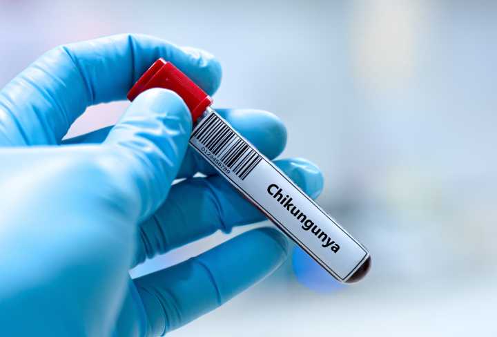 Valneva Updates Safety Label of Chikungunya Virus Vaccine