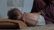 'We cannot rely on starving individuals to control their own refeeding'