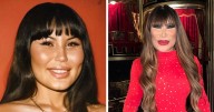 20 Celebrities Who Destroyed Their Face With Cosmetic Procedures