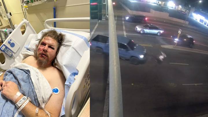 Glendale veteran still recovering from injuries sustained in hit