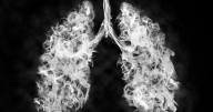 This lung disease can be dangerous for younger people, too