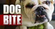 Dog bites woman in Madison, public health seeks information to prevent rabies shots