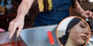 Vendedora informal denunció agresión física en pleno centro de Bogotá: “Le volvieron nada la cara”