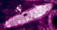 NYC Legionnaires’ disease cluster grows to 99 cases, 4 deaths