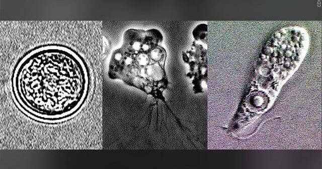 Missouri health officials: Person contracted 'brain-eating amoeba', was at Lake of the Ozarks before falling ill