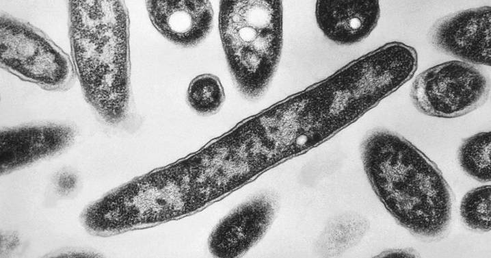 New York Legionnaires’ outbreak: 58 ill, 2 dead