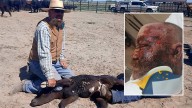 Burned To Bone In Welding Explosion, Jeffrey City Father Of 5 Faces A New Reality