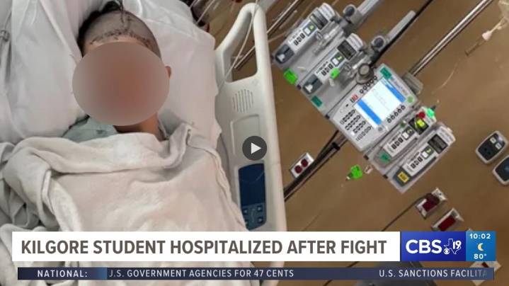 'No reason for violence' | Kilgore student hospitalized following altercation, sparks concerns among parents