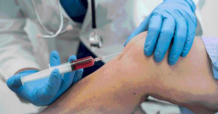 Este nuevo tejido mamífero podría ser la clave para regenerar el cartílago y tratar lesiones traumáticas