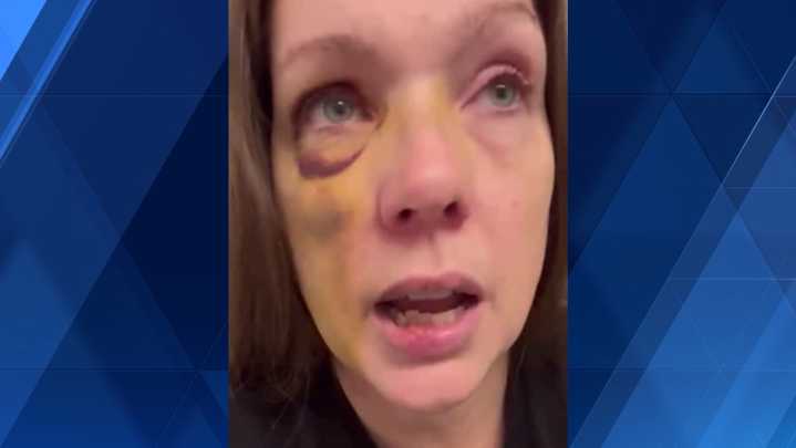 Woman assaulted in viral downtown brawl video speaks out for the first time