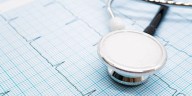 Una calculadora mejorada predice el riesgo de accidente cerebrovascular en pacientes con fibrilación auricular