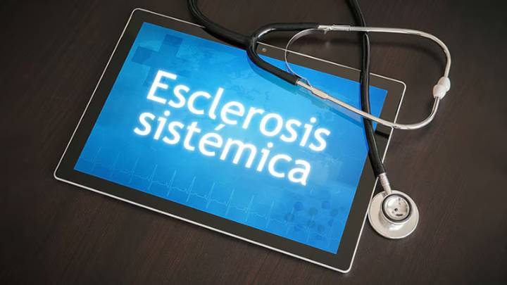 ¿Cuál es la mejor opción de inmunosupresor en esclerosis sistémica difusa? Resultados de una comparación