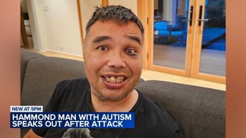 Scott Lindsey, Hammond, Indiana man with autism, attacked while biking through Hessville Park: 'They started hitting me'