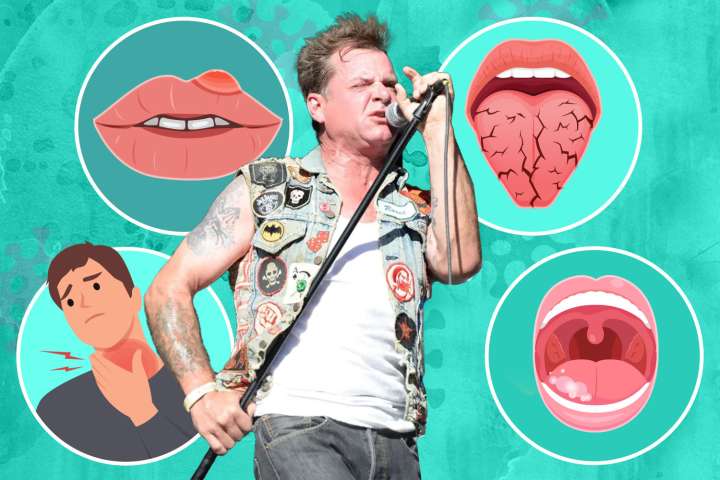 From mouth ulcers to a sore tongue - the 7 signs of ‘very aggressive’ cancer as rock star dies aged 59