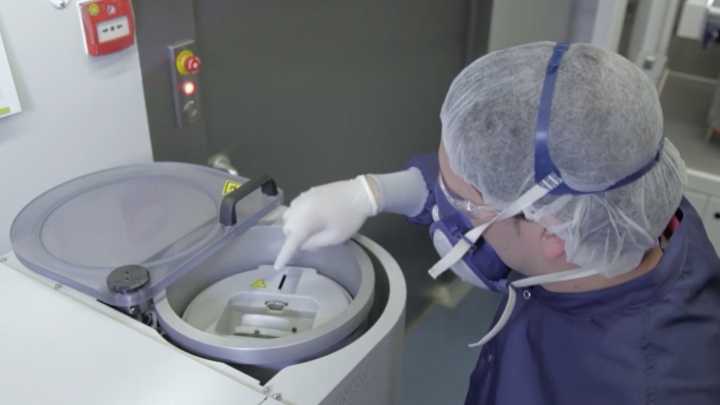 La falta de litio en el cerebro podría ser clave en el desarrollo del Alzheimer