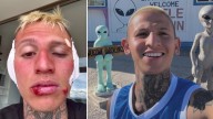 La Liendra reaparece en redes con un preocupante aspecto y revela la insólita razón: «Casi pierdo mis orejitas»