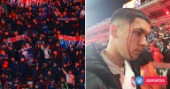 Vergüenza azul en Argentina: suspenden duelo de La U por la Sudamericana por desmanes en tribunas