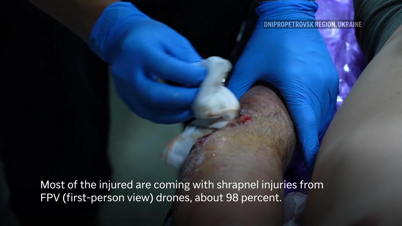 Ukrainian soldiers treated for injuries suffered in Russian FPV drone strikes near frontline