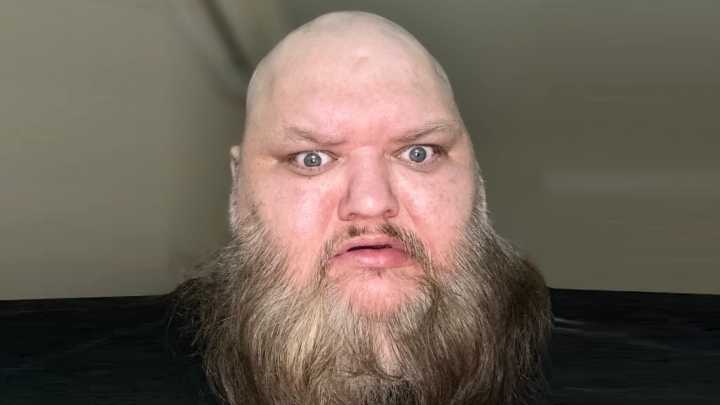 TikTok star John E Crawley's cause of death at 47 is confirmed after influencer known as KingBeardX spent 2 weeks in ICU