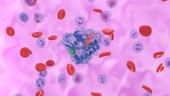 KRAS Inhibitor Reduces Progression Risk in Pretreated Lung Cancer