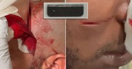 Two NYC Correction officers badly slashed by detainee on Rikers Island