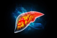 89bio: Promising As Pegozafermin Nears Phase 3 Readout (NASDAQ:ETNB)