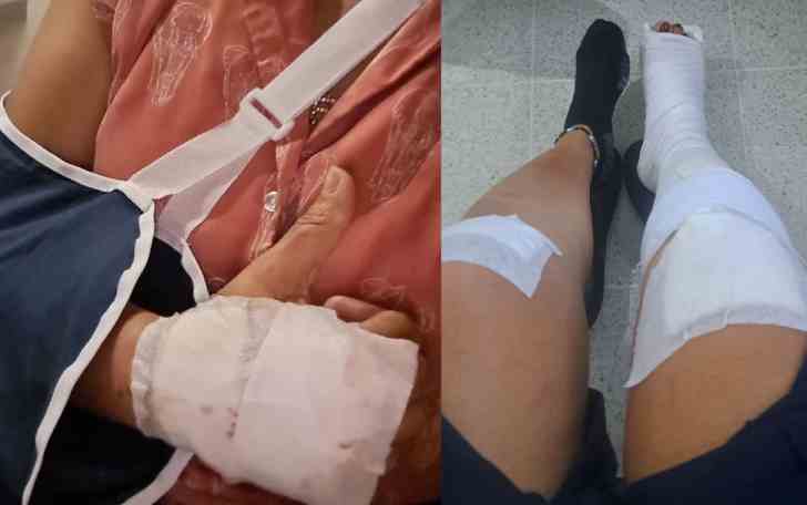 Mujer fue derribada de su moto para atracarla en Floridablanca: resultó herida