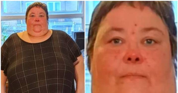 Gran's dramatic 'before and after' as she transforms her body with two life changes