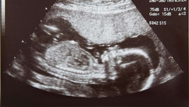 Homeschooled Kid Graduates High School 5 Months Before Birth