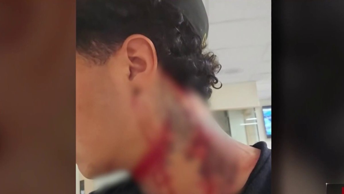 Nuevos detalles sobre la agresión a martillazos a un hombre en panadería de East Boston