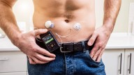 Diabetes Tech Use On the Rise But A1c Reductions Still Lag