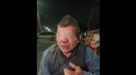Golpean a sujeto que intentó abusar de menores en Hidalgo