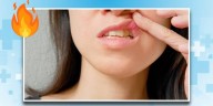 El mejor remedio casero para combatir los fuegos bucales o aftas