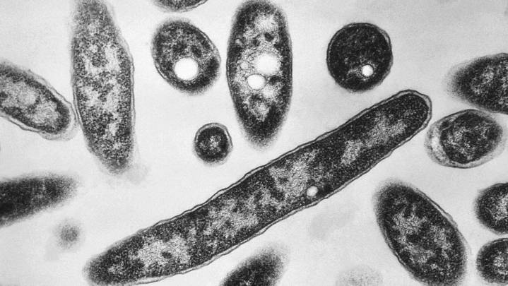 Acting health commissioner addresses Legionnaires’ disease