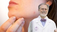 Jerónimo Ors, farmacéutico: "El sol y el calor pueden provocar el temido acné de Mallorca en tu piel"