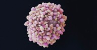 Una nueva terapia combinada reduce el riesgo de progresión del cáncer de mama triple negativo en un 52%