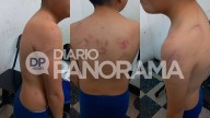 Detienen a una catequista por golpear salvajemente a su hijo de 8 años: fue denunciada por su propio hermano